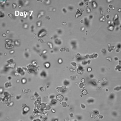 VitroGel COLを用いた膠芽腫細胞（SNB-75）の三次元培養3
